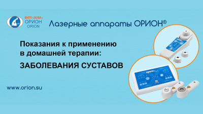 Как лечить ЗАБОЛЕВАНИЯ СУСТАВОВ лазером ОРИОН