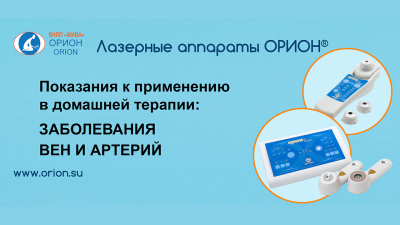 Как лечить ЗАБОЛЕВАНИЯ ВЕН И АРТЕРИЙ лазером ОРИОН