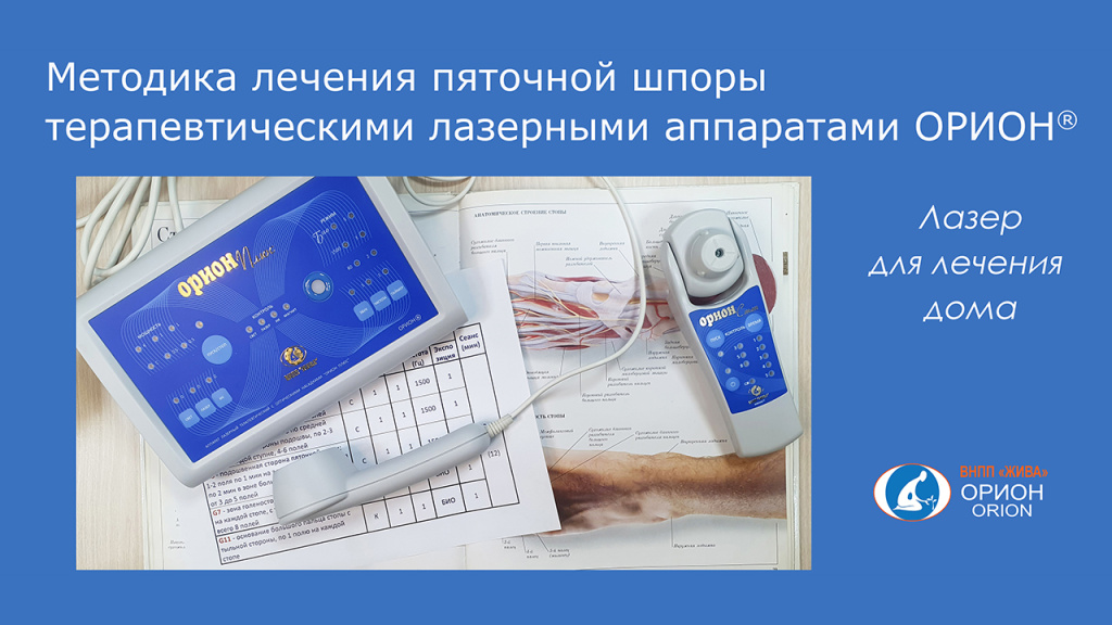 ! Обложка 1280-720 Пяточная шпора.jpg