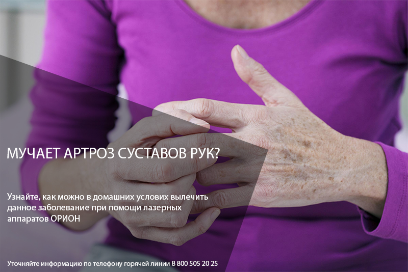 Домашнее лечение артроза суставов рук