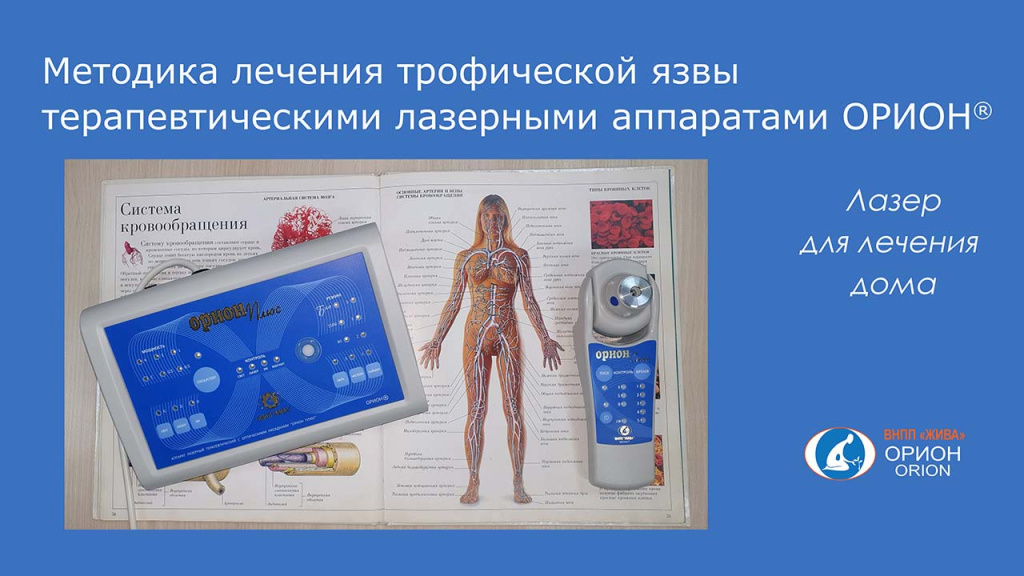 ! Обложка 1280-720 троф язва - расы и рассылка.jpg